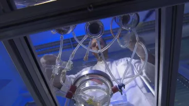 Image: Preparation of the implant
