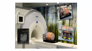 Image: magnetic resonance (MR)- positron emission tomography (PET