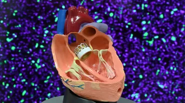 Bacterial infections in the cardiovascular system are the subject matter of the Else Kröner Graduate Research Program IKARUS at Jena University Hospital.