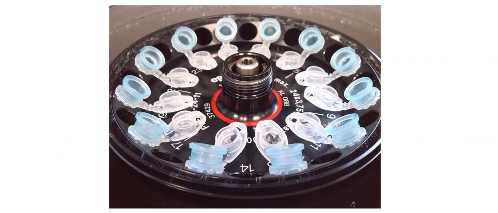 Plasmid isolation