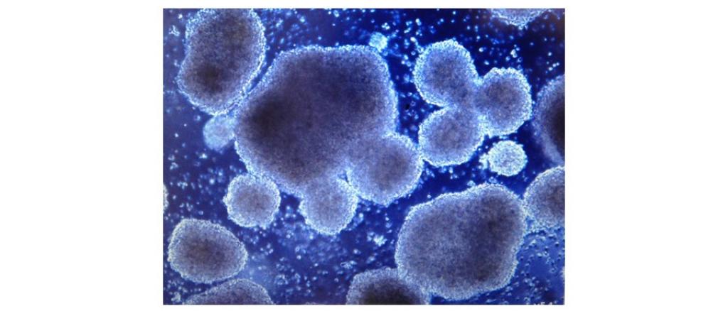 Picture of a CAR-T cell culture on day 3 of ex vivo expansion
