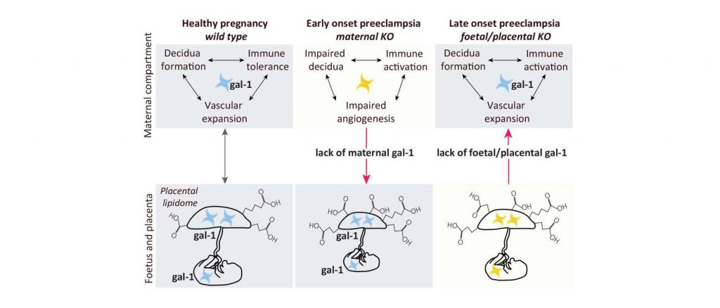 Untersuchung der Galektin-1-Zucker-Metabolom Achse in gesunden und Präeklampsie-Schwangerschaften