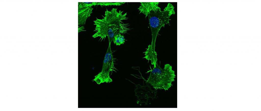 Role of atypical MAPKs in cell shape