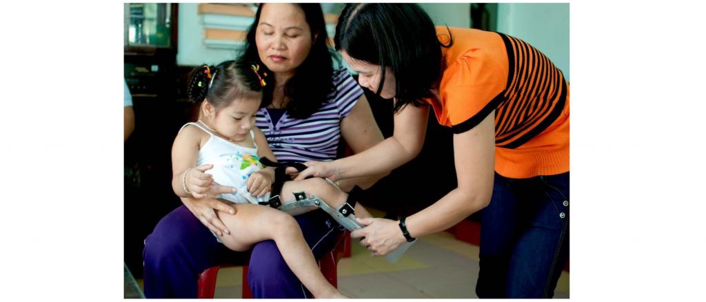 Als Nguyen Tran Le Uyen (3 Jahre) 2 Jahre alt war, wurde bei ihr eine Hemiplegie diagnostiziert. Die Orthesennanpassung und die folgenden rehabilitativen Behandlungen helfen ihr nun doch noch unbeschwert laufen zu lernen.