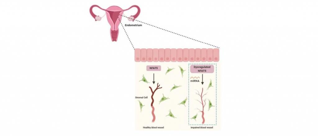 Die Rolle von NFAT5 und beeinträchtigter Entwicklung der endometrialen Blutgefäße.