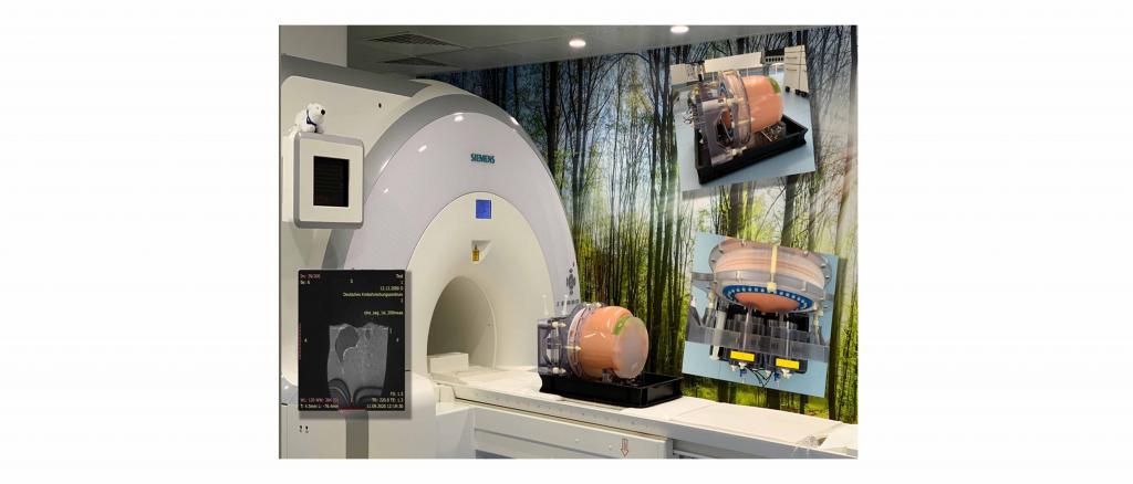 Image: magnetic resonance (MR)- positron emission tomography (PET